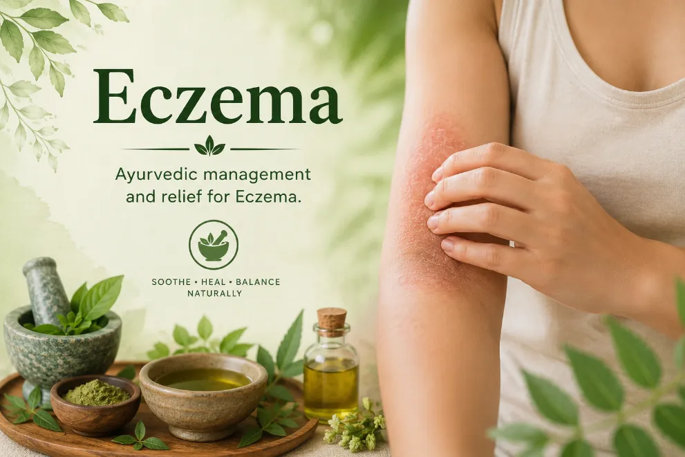 Eczema